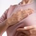 UAESA reportó 19 casos de cáncer de mama y cuello uterino en Arauca durante 2026